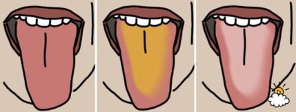 1. 혀의 색깔

가장 빠르고 쉬운 방법이다. 자신의 혀를 거울에 비춰 색깔을 보라. 무슨 색인가? 분홍색이라면 별문제 없다. 다만, 노랗거나 흰색이라면 혀 표면에 박테리아가 서식 중일 수 있다. 박테리아는 대표적인 입 냄새의 원인이다.